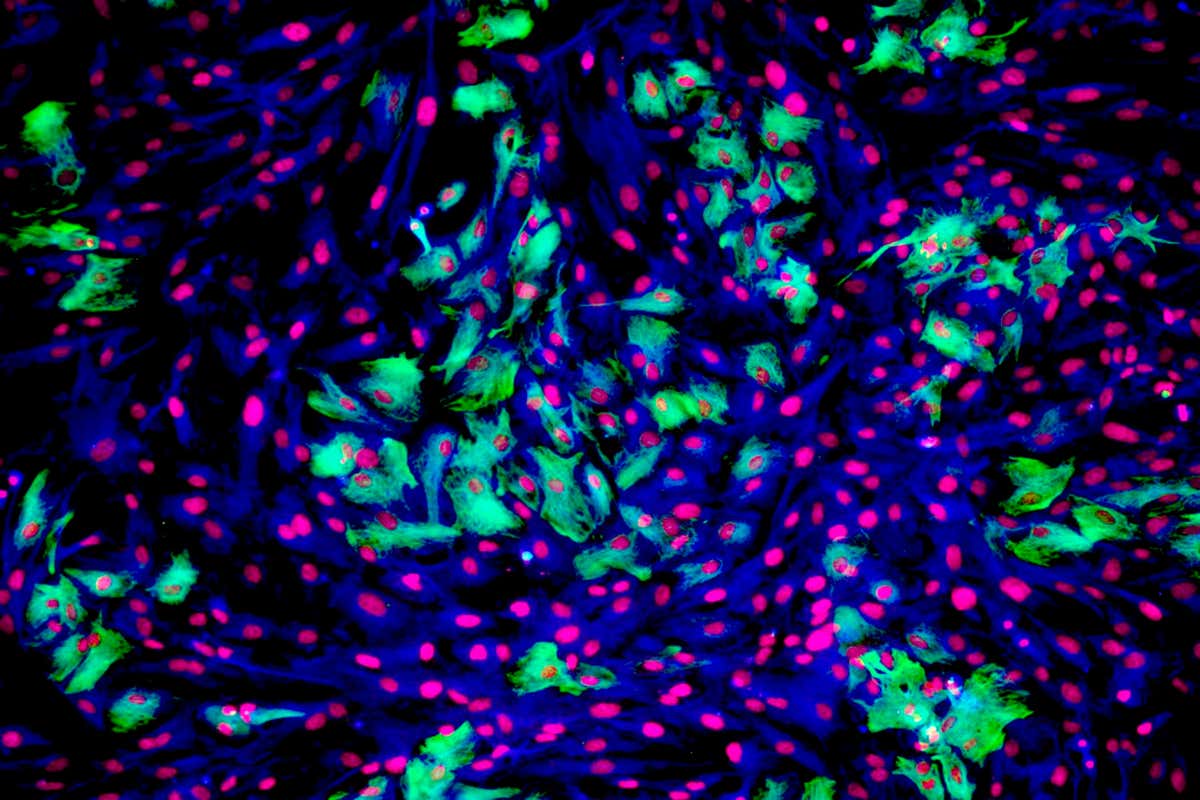 Astrocyte brain cells. Fluorescence light micrograph of primary astrocyte cells from the brain of a mouse. Astrocytes have numerous branches of connective tissue that provide support and nutrition to the neurons (nerve cells) of the brain. Glial fibrillary acidic protein (GFAP) is green; cell nuclei are magenta; actin filaments are blue.