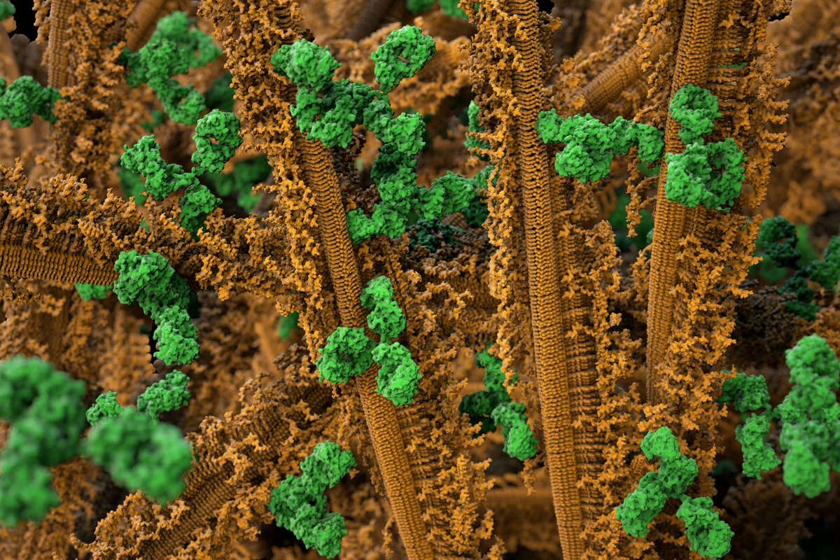 Aggregates of the protein alpha-synuclein (brown) and antibodies (green)